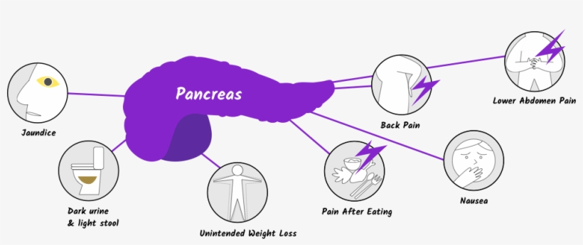 Signs And Symptoms Of Pancreas 